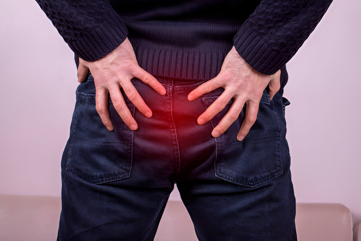 Best Piles Doctor In Andheri